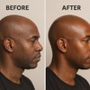 Bald Head Moisturizer. Soothes and Conditions the Scalp. Creamy Balm