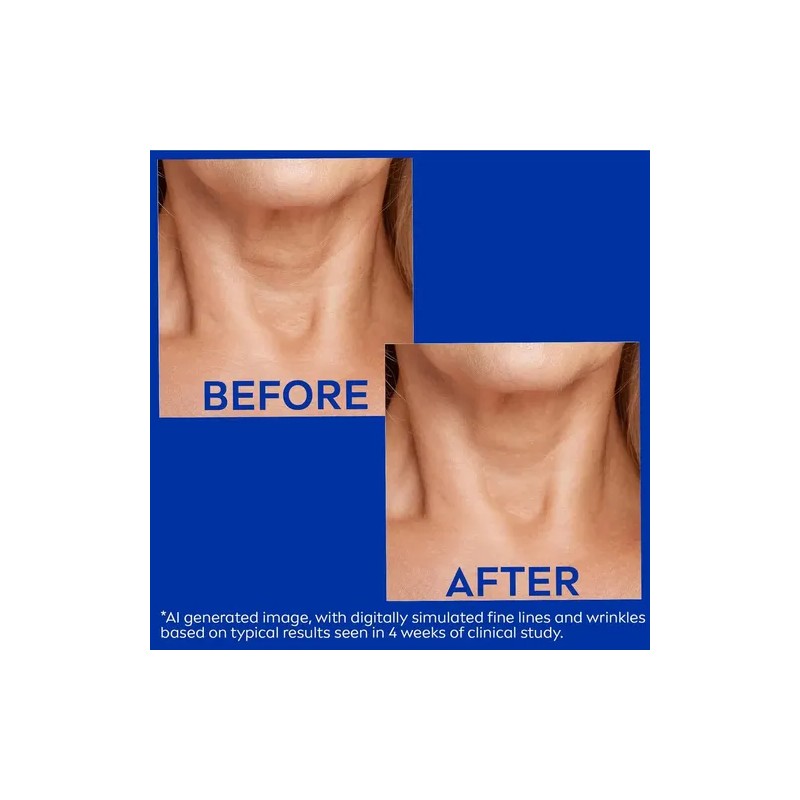 Nivea Crema Reafirmante Y Antiarrugas Para El Cuello Y El