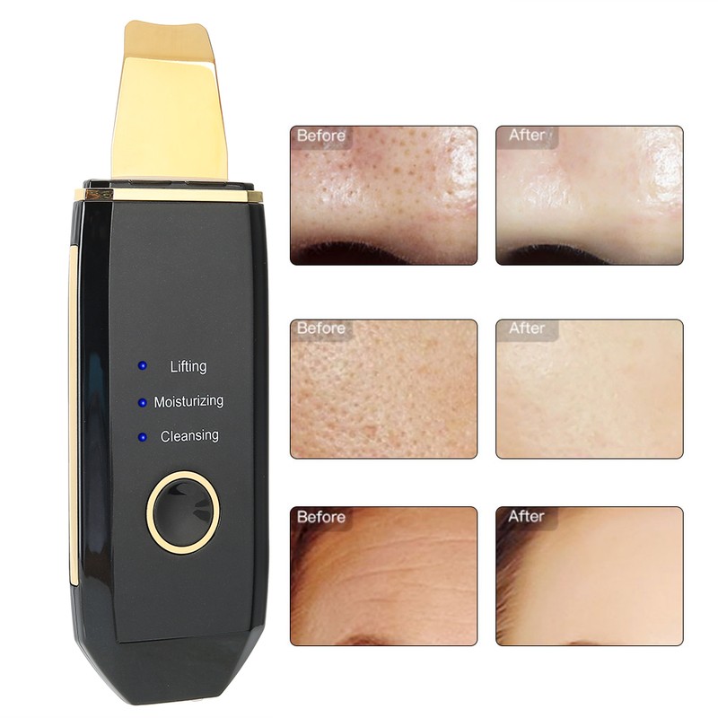 Ultrasonic Skin Scrubber Blackhead Removal Face Cleaning Skin Rejuvenation Machine