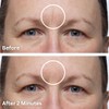 Dermaflage Scar Filler Refill, 4 Applicators