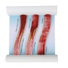 Lipoprotein LDL Blood Vessel Model Low Density Blood Lipid Vessel