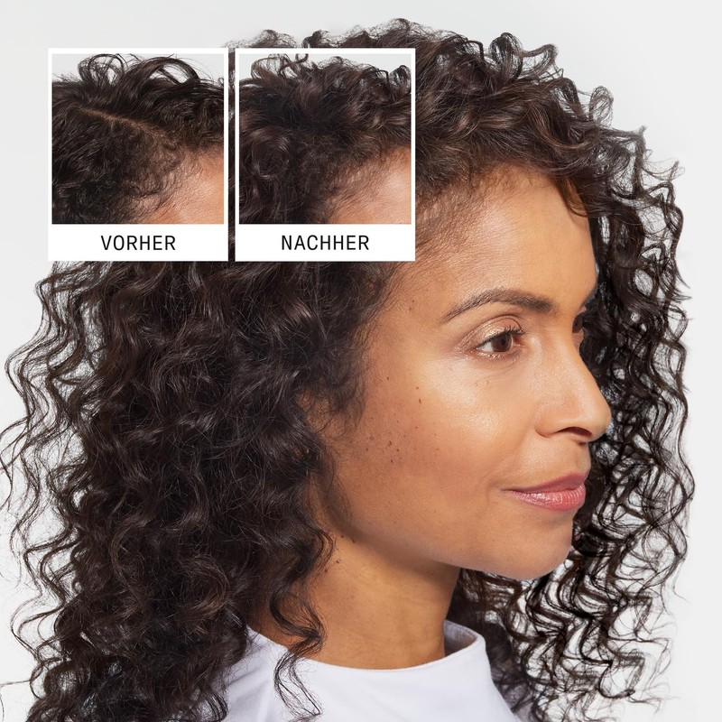 Nioxin Anti-Hair Loss Shampoo - Hair Loss Shampoo with Caffeine