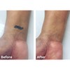Tattoo Cover Up Makeup, Bruise Concealer, Waterproof, Smudge proof, 3