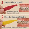 Orthodontic Rubber Bands Tool 100-Pack Disposable Elastic Braces Placer with