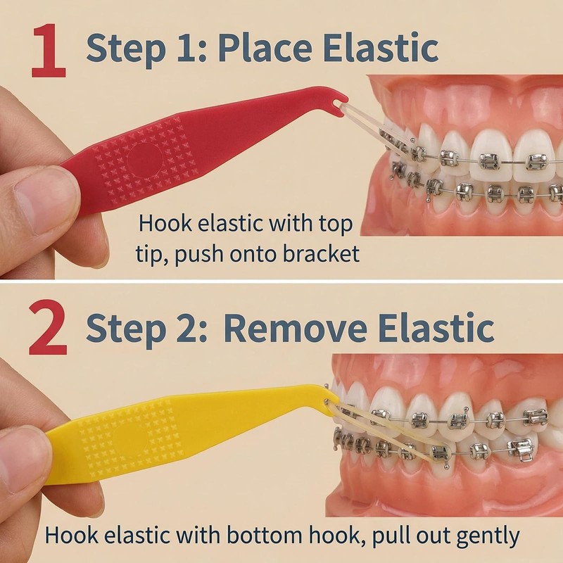 Orthodontic Rubber Bands Tool 100-Pack Disposable Elastic Braces Placer with