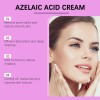 Ouyea Crema Para El Acné Que Contiene Ácido Azelaico