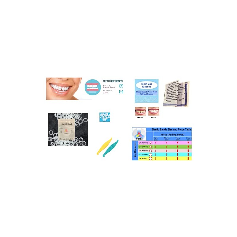 IVORIE® Teeth Gap Bands Orthodontic Bands Clear Dental Elastic Bands