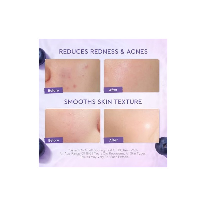 crema facial con 5X Ceramides y Blueberry, crema para la