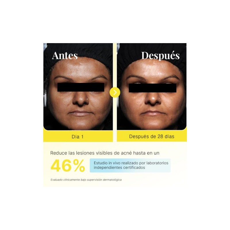 Protector Solar Facial FPS 50 PA+ Piel Grasa 50 ml