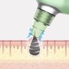 Heating Vacuum Blackhead Remover Gentle Micro Bubble 3 Suction Levels