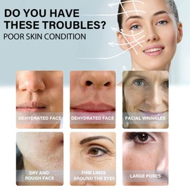 Proform Korean Soluble Protein Thread, Profirm Korean Soluble Protein Thread, Protein Threads for Face, Instalift Korean Protein Thread Lifting Set, Absorbable Collagen Thread (3Box (180Pcs))