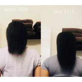 TC Beauty Hair Growth Product For Men Women Natural Oil Serum Loss Grow  TCBEAUTY 30ml