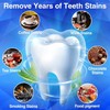 Whitening Strips Bleaching Teeth Stripes: MrDoggy Whitening Stripes, Teeth Whitening