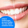 Polierpaste professional, Zahnpolierpaste mit Hydroxylapatit, Reingungspaste für Zähne 10 x