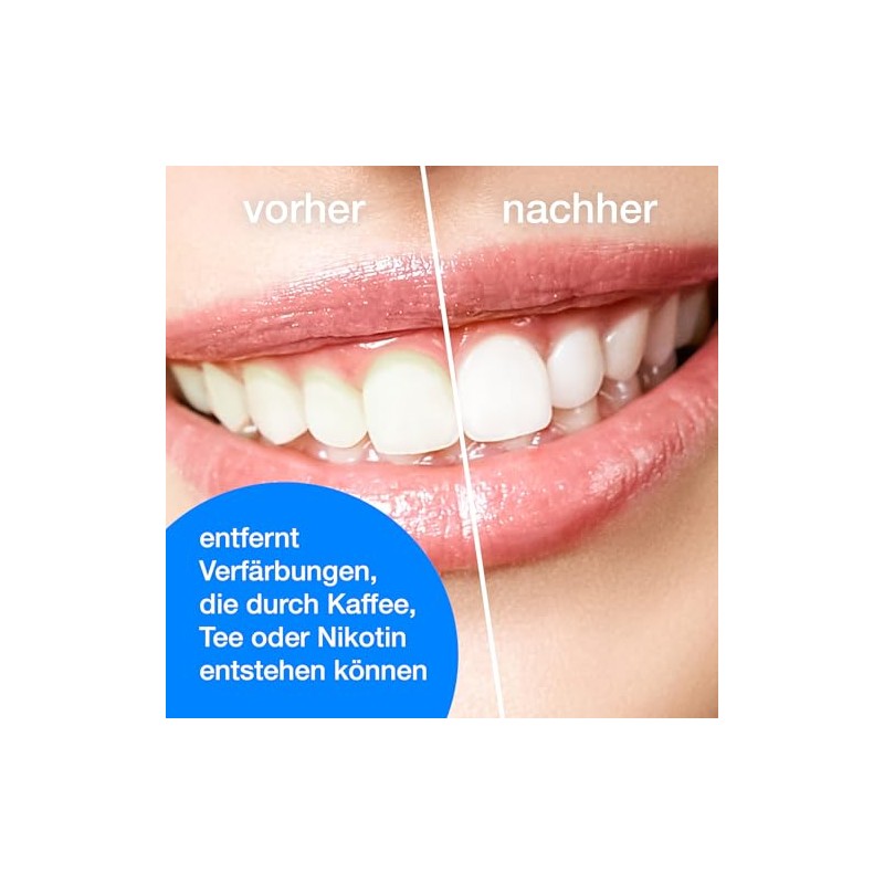 Polierpaste professional, Zahnpolierpaste mit Hydroxylapatit, Reingungspaste für Zähne 10 x
