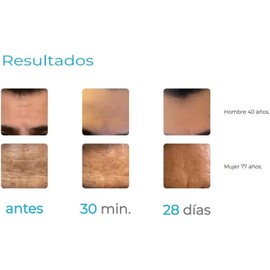 Sérum Derma&co. Derma Ahb5 Lineas De Expreción 30 Ml. Todo Tipo De Piel Día/noche