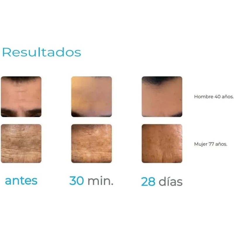 Sérum Derma&co. Derma Ahb5 Lineas De Expreción 30 Ml. Todo