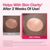 Lingtoolator Spot Correcting Serum / 10% Niacinamide+ 4% Tranexamic Acid,