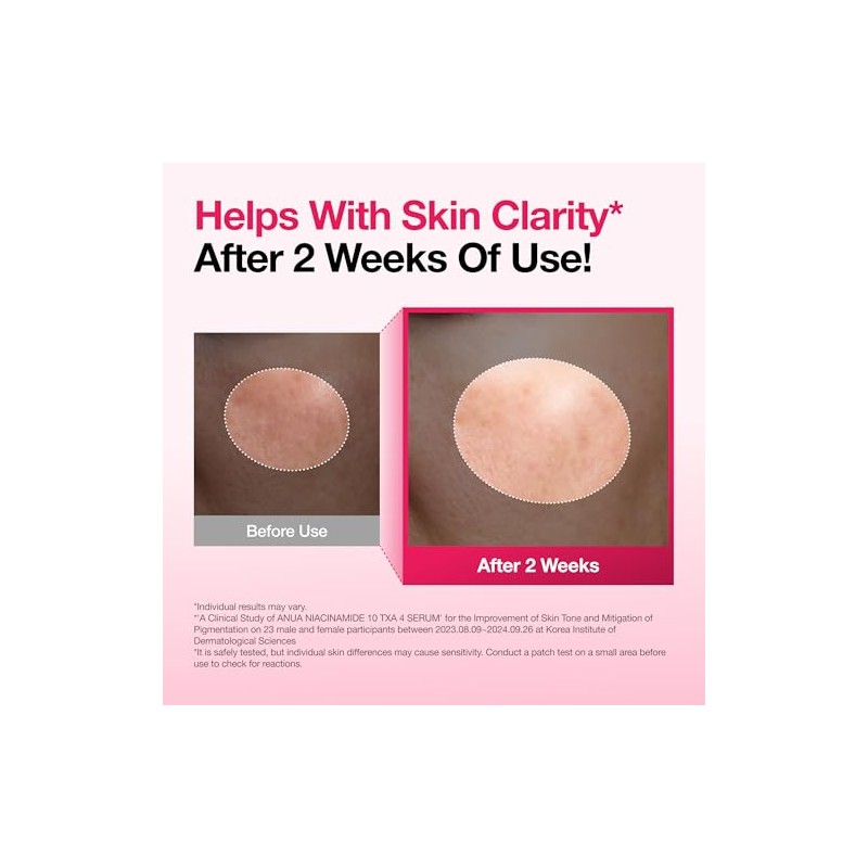 Lingtoolator Spot Correcting Serum / 10% Niacinamide+ 4% Tranexamic Acid,
