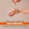 Adult Acnomel Acnomel Acne Spot Treatment 1.3 Ounce Adult Formula