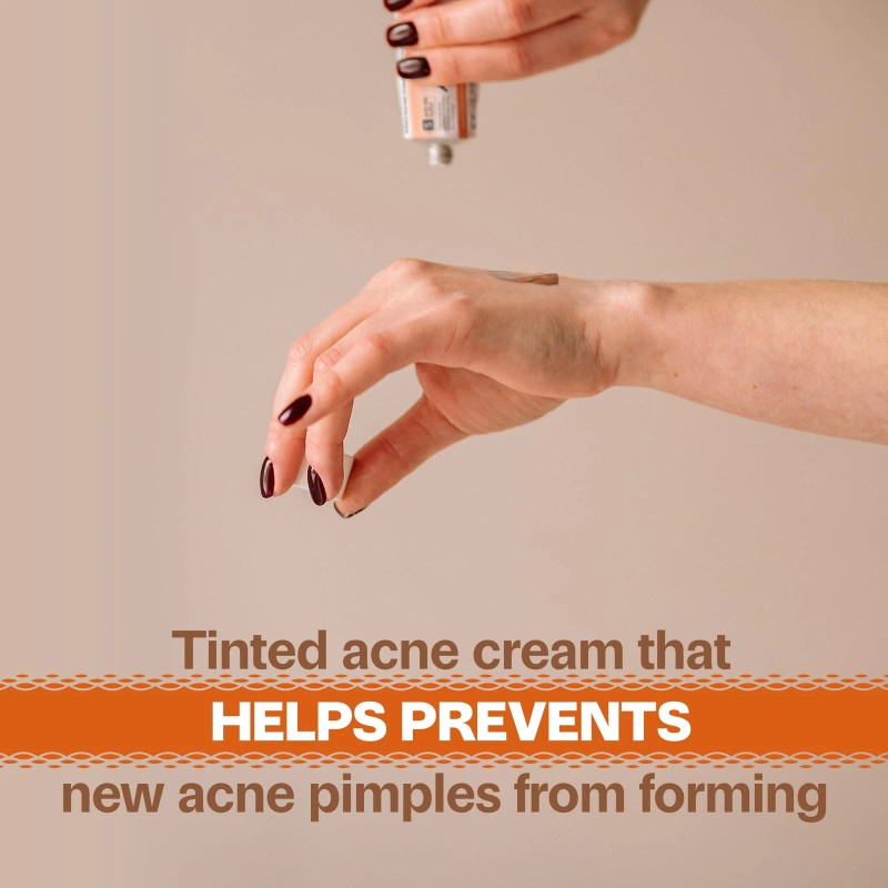 Adult Acnomel Acnomel Acne Spot Treatment 1.3 Ounce Adult Formula
