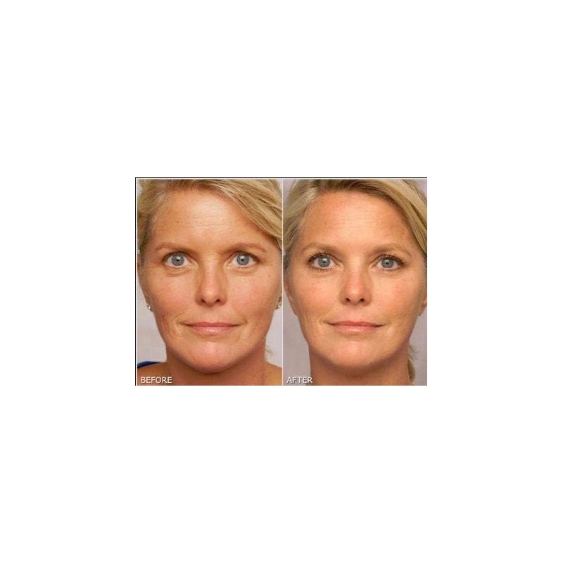 Retinol Gel 0.1 Vitamin A Repairs Fine Lines Wrinkles, Scar