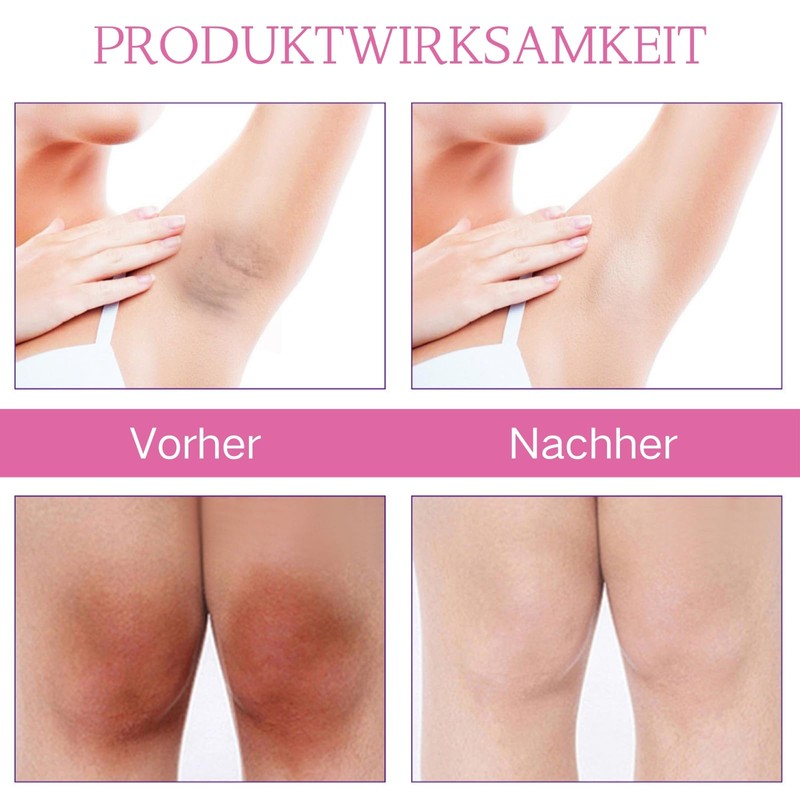 MrCuvaryas Kojic Acid Underarm Cream for Underarms