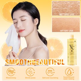 VC Toner, VC Toner Refreshing Hydrating Rejuvenating, Hydrating Facial VCToner,Deep Moisturing, Refreshing Water Lotion for All Skin Types, 300ml