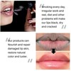 N.A.S.E 2PCS Lips Pink Fresh Lightening Bleaching Cream Treatment Remove