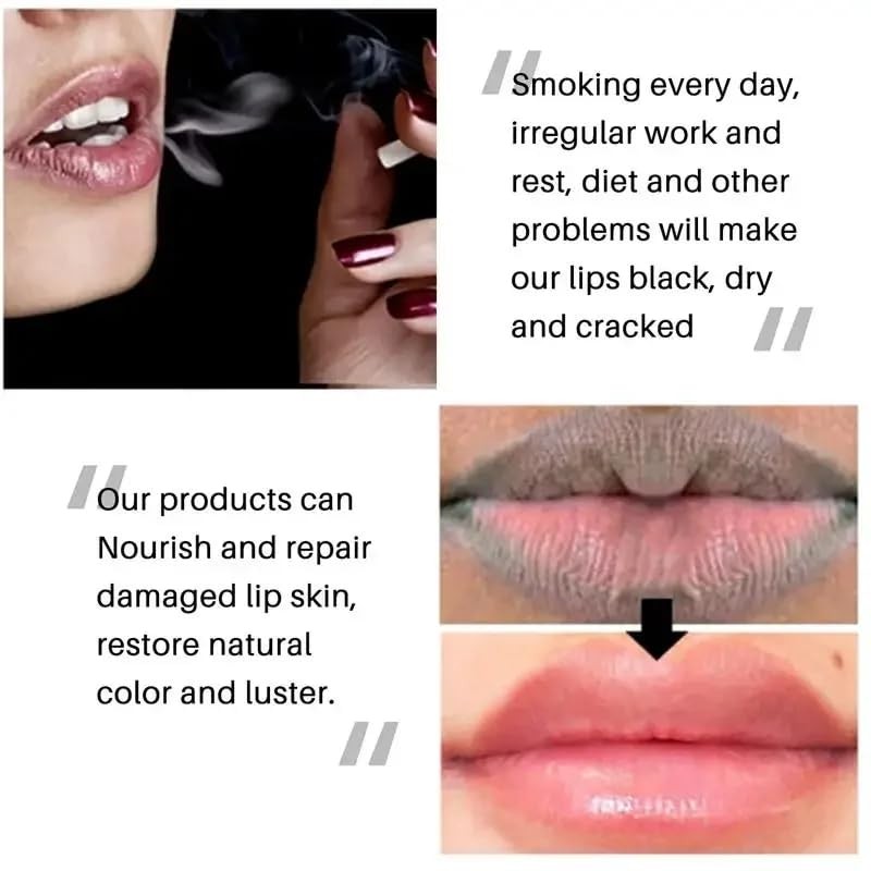 N.A.S.E 2PCS Lips Pink Fresh Lightening Bleaching Cream Treatment Remove