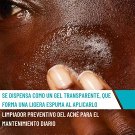 Jabon para la cara Cerave Cleanser Acné en Gel para Control Puntos negros oleosidad 473ml