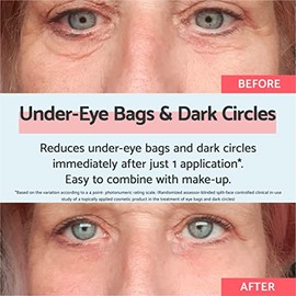 Remescar Eye Bags & Dark Circles 8ml Instant Eye Cream