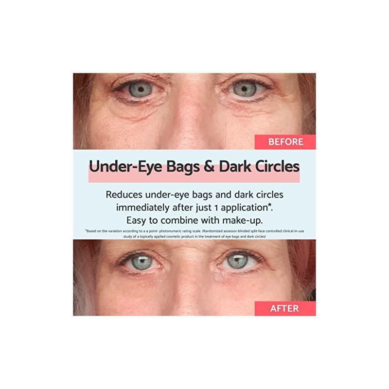 Remescar Eye Bags & Dark Circles 8ml Instant Eye Cream