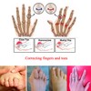 8 Pieces Toe Splint Wraps Non Slip Hammer Toe Straightener
