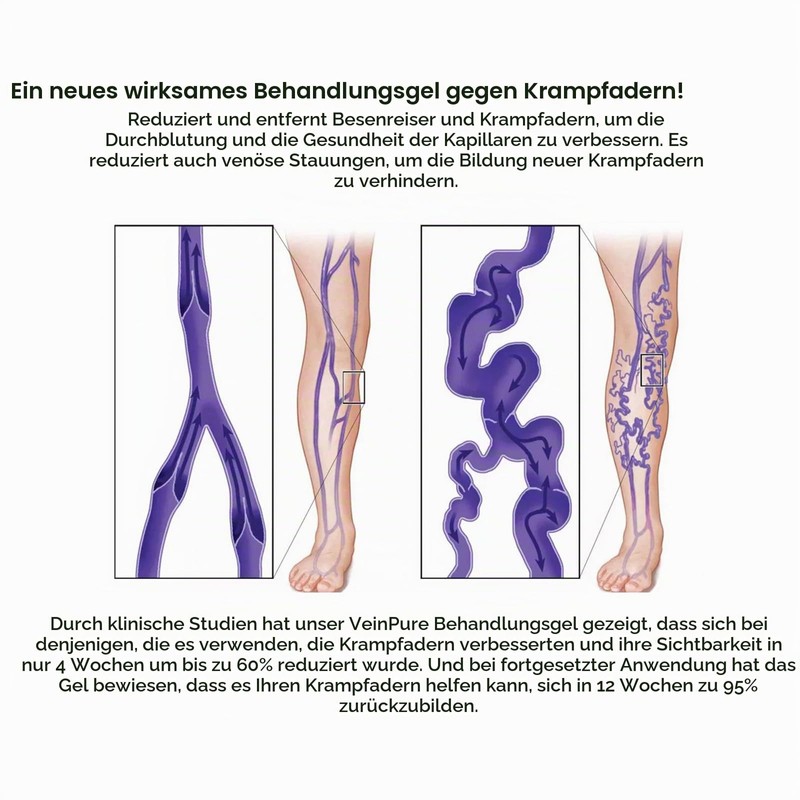 Varicose Veins Cream, Spider Vein Removal, Gentle Leg Care, Improves