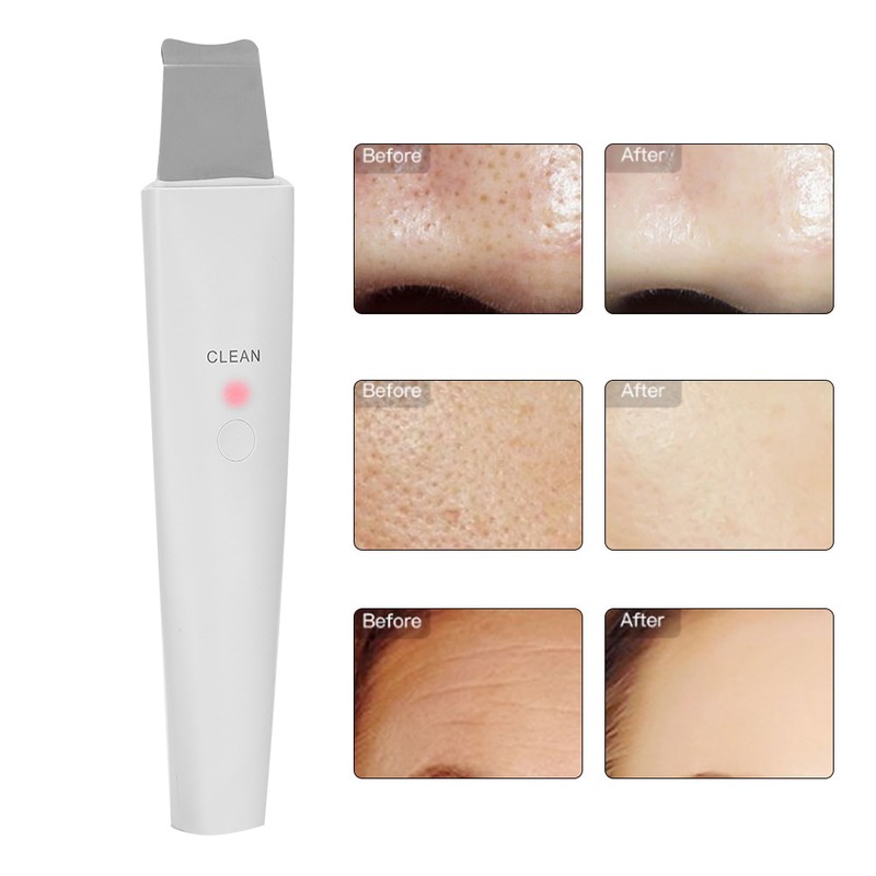 Ultrasonic Skin Scrubber Blackhead Removal Face Pore Cleanser Beauty Instrument