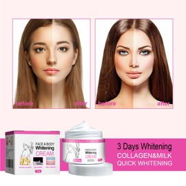 Hautaufhellungscreme für jeden Hauttyp,Skin Brightening Cream,Unterarm Whitening Cream,Körperaufhellungscreme, Anti Aging für Frauen & Männer,30g 2pc