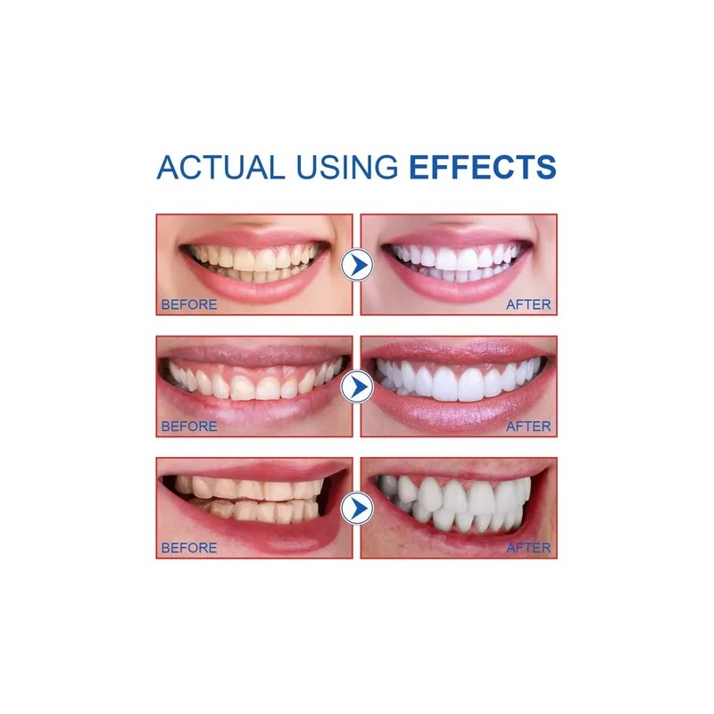 Sp-6 Whitening Probiotics Toothpaste Toothbrushes, 3pcs