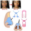 Nose Lift Up Shaping Clip Shaper Kit, 3Pcs/Set Nose Massager