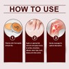 Lmoy 2PCS Therawolf Neuro Balm, Nerve Relief Balm for Neuropathy,