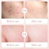 Tónico Facial, Esencia Rosas+acido Hialurónico, Hidratante