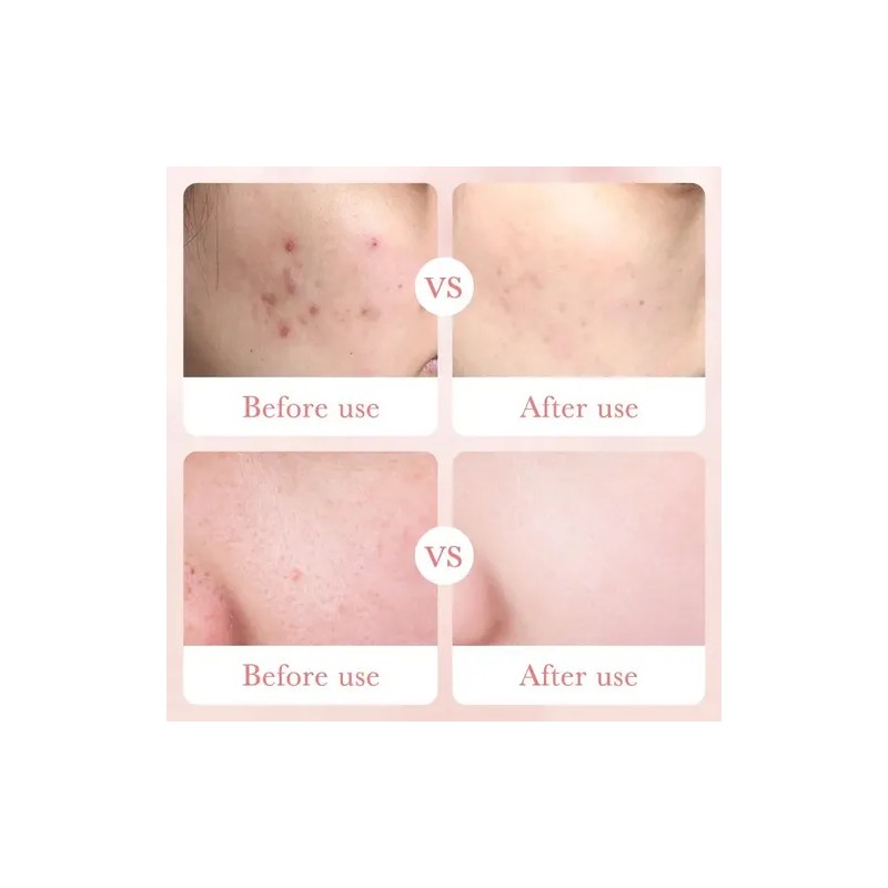 Tónico Facial, Esencia Rosas+acido Hialurónico, Hidratante