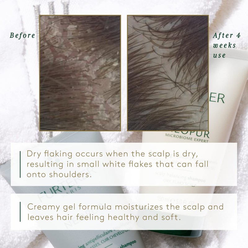 Rene Furterer Neopur Shamy Oily Dandruff