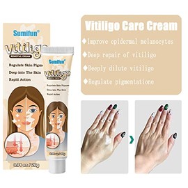 Crema Para El Vitíligo, Crema Para El Tratamiento Del Vitíligo, Psoriasis, Reducir El Vitíligo, Mejorar La Pigmentación De La Piel (Paquete de 3)