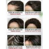 Sérum Crecimiento Cabello Calvicie Favorece Crecimiento 30ml
