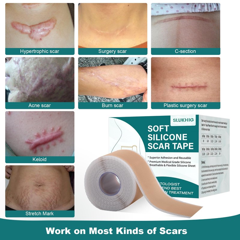 Silicone Scar Sheets (1.6"x 79" Roll-2M), Silicone Scar Tape for