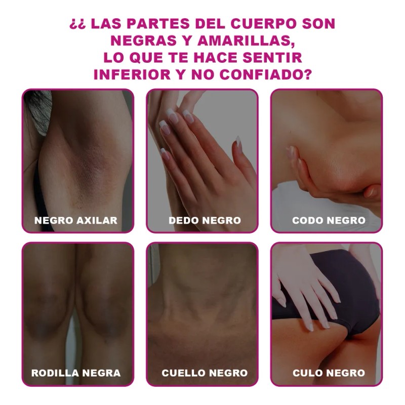 Aceite Acantosis Nigricans, Mejora La Hiperpigmentac Neutra