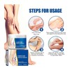 Lmuwecno Varicose Veins Cream(1PCS)