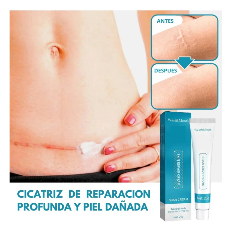 Crema Despigmentatnte Manchas Cicatrices Paño
