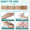 Silicone Scar Sheets, Silicone Scar Tape(1.6"x 158"), Scar Tape for